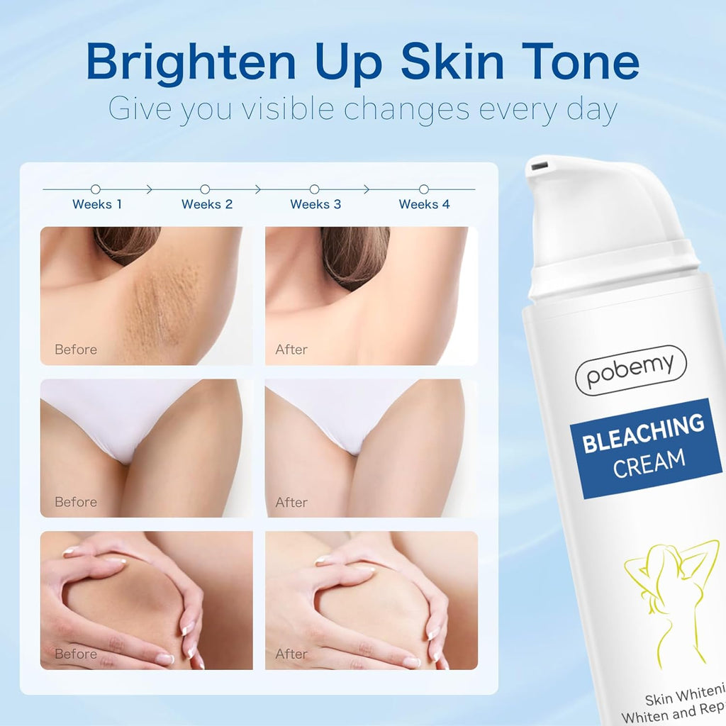 Skin Bleaching Cream, Dark Spot Remover for Face, Intimate Areas & Body, Vitamin C Whitening for Underarms, Knees, Elbows, Inner Thighs, Bikini Line – Sensitive Skin Lightening Cream- 1.7FL OZ