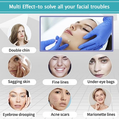 ESTEVO PDO Mono Threads Lift, for Face and Body PDO Thread For Skin Tightening and Reduce Wrinkle (20PCS-27G*60mm)