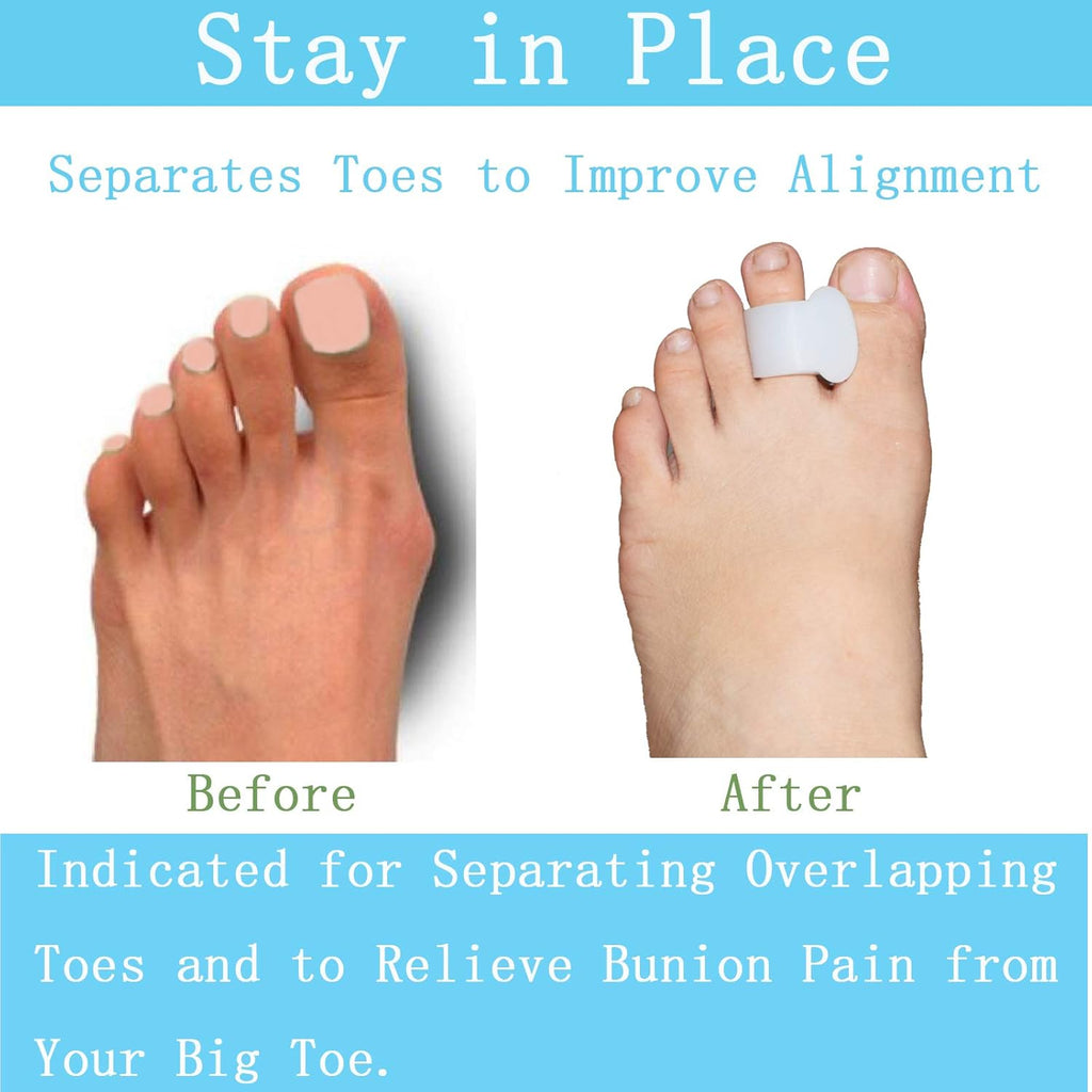 Pack of 12 Gel Toe Separator, (1/4" Thick) Big Toe Spacers, Single Loop Toe Spreader for Bunions, Overlapping Toe, Corrector and Spacer (Clear)