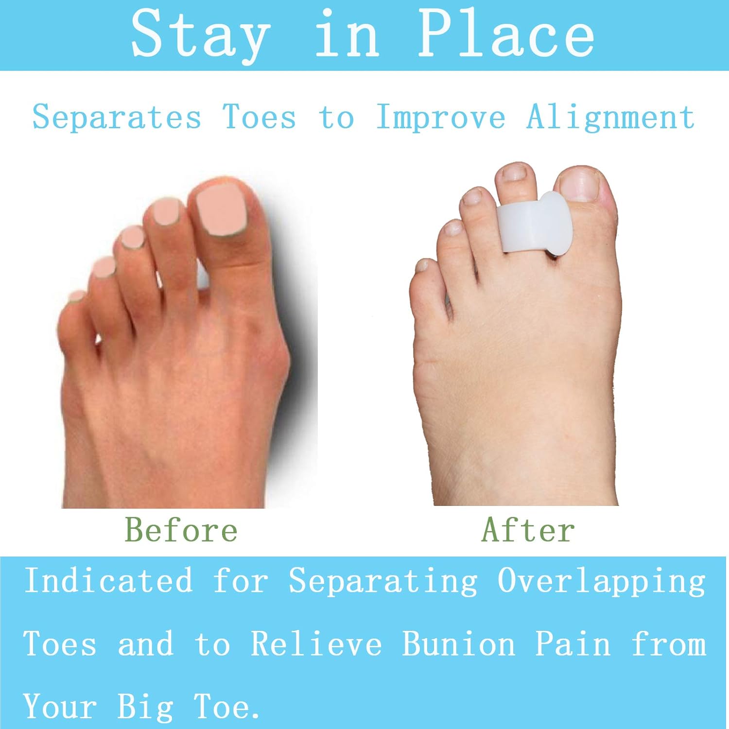 Pack of 12 Gel Toe Separator, (1/4" Thick) Big Toe Spacers, Single Loop Toe Spreader for Bunions, Overlapping Toe, Corrector and Spacer (Clear)