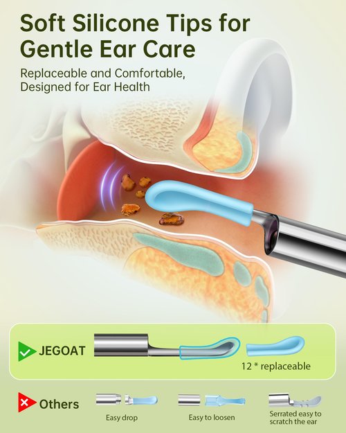 Ear Wax Removal Tool Camera, Ear Cleaner with Camera, Ear Cleaning Kit 1296P HD Ear Scope and 6 LED Lights, 10 Ear Pick Tips, Earwax Removal kit with Otoscope to Earify Earwax for iOS and Android