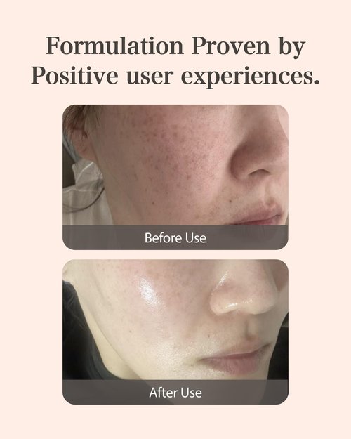 Mastina Mastic Ampoule (Dropper Type, 0.5fl oz) - Dark Spot Remover Face Serum for Even Skin Tone. Fermented Mastic Gum. White Mastic Complex 63% + Tranexamic Acid 2% + Niacinamide 5%