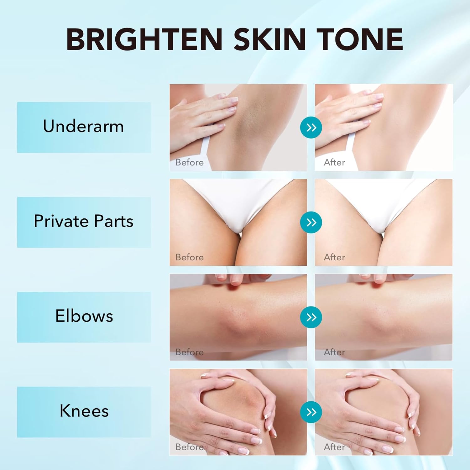Skin Lightening Cream, Dark Spot Remover for Face Body Bleaching Cream for Intimate Areas & Body, Vitamin C Whitening for Underarms, Knees, Elbows, Inner Thighs, Bikini Line (1.7 Fl Oz)