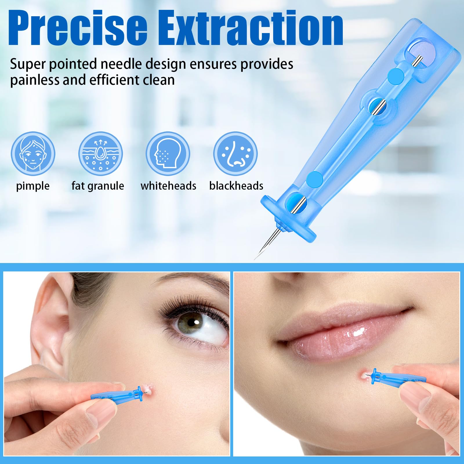 Sterile Needles for Pimples, 100Pcs Disposable Acne Needles Effective Blemish and Blackhead Removal Tools for Clear Skin