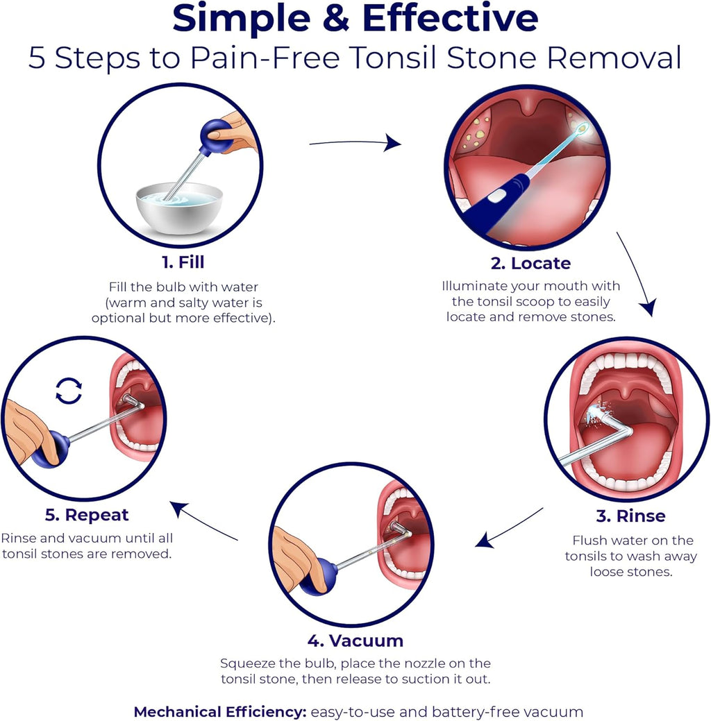 Oravix Tonsil Stone Vacuum, Tonsil Stone Remover Vacuum Suction, Tonsil Stone Cupping Tool, Tonsil Stone Removal Tool with Suction, Tonsil Stones Removal Vacuum, Tonsil Stone Extractor - 3 in 1 Kit