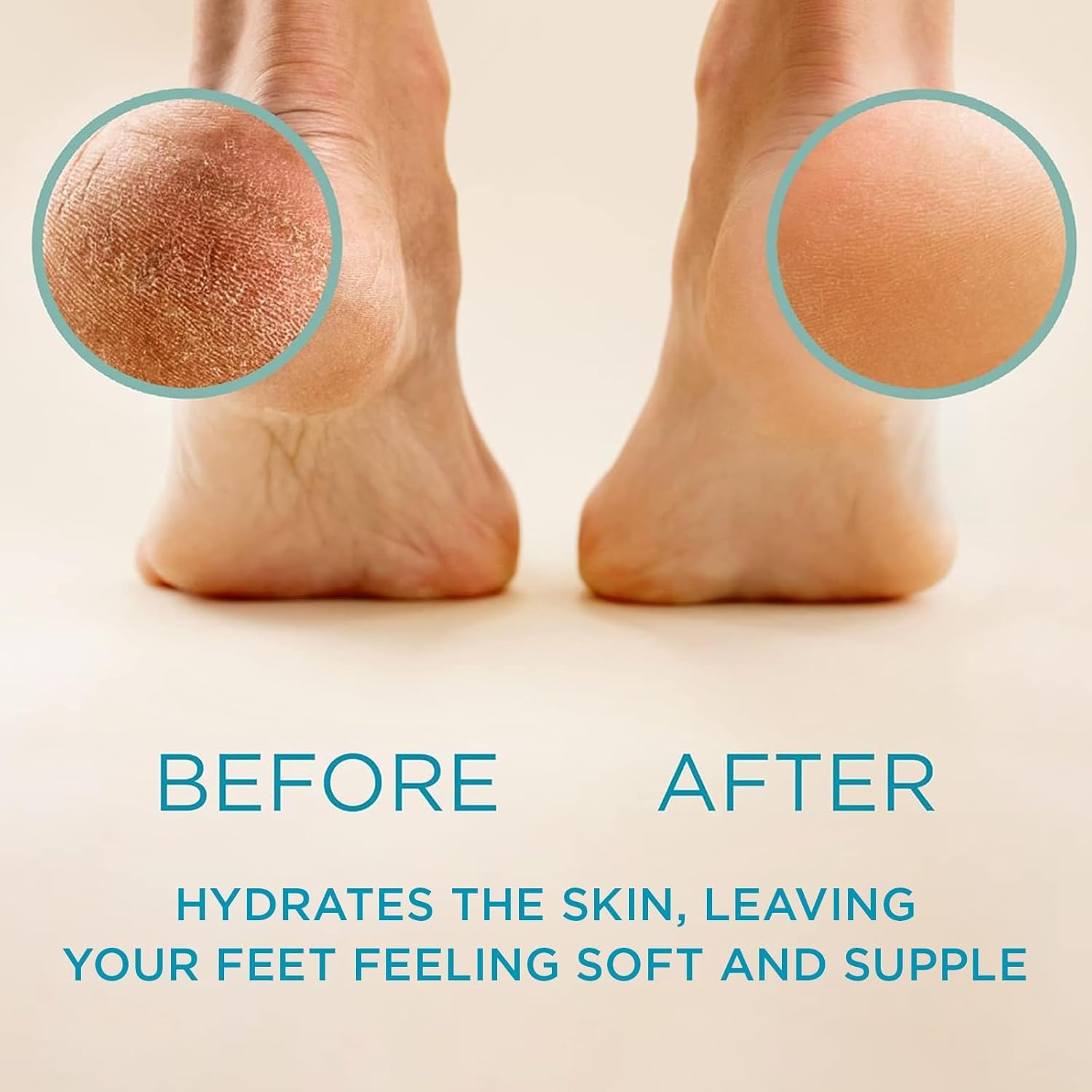 Lee Beauty Professional Callus Remover for Feet - Original, Powerful Formulation - Extra Strength Gel, Home Pedicure Foot Spa Results - Cracked & Dead Dry Skin Supplies - 8 Oz