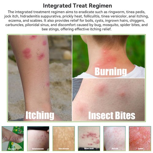 3pcs Max Strength Natural Organic Manuka Honey Cream Ointment, Soothing Relief for Dry, Heat Rash, Itchy, Tinea Versicolor, Psoriasis, Leg, Belly, Armpit, Foot, Hand, Irritable Skin, All Ages