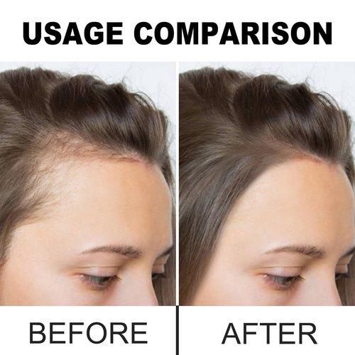 Divine Vitals Batana Oil for Hair Growth, Divine Vitals 100% Organic Batana Hair Growth Oil, 100% Raw from Honduras, Prevent Hair Loss, Adds Thickness, Texture, Shine (1PCS)