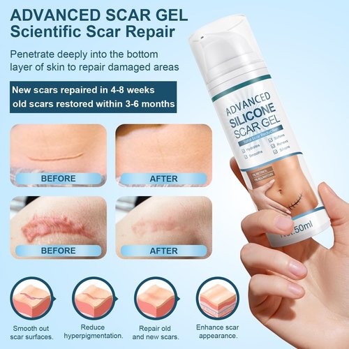 Advanced Scar Gel, Silicone Scar Gel, Treats Old and New Scars, Reduces the Appearance of Scars from, Body, Face, Stretch Marks, Surgical Scar, Keloids, Acne, Burns and More, 50g (1.76 Oz)