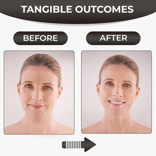 Silicone Face Tape | Anti-Wrinkle Face Tape | 2 Rolls with Different Widths for Custom Fit | Toning, Firming & Tightening Tape | Gentle on Sensitive Skin | Overnight Hold for Wrinkles and Fine Lines