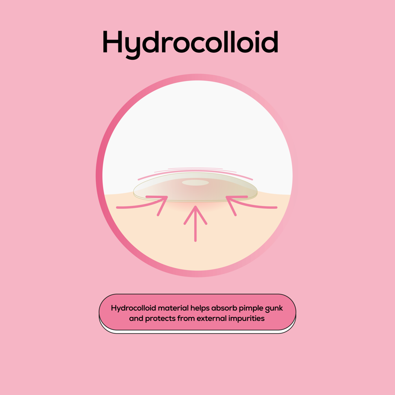Hydrocolloid Acne Patches for Blemish Treatment - Latex-Free, 36 Count