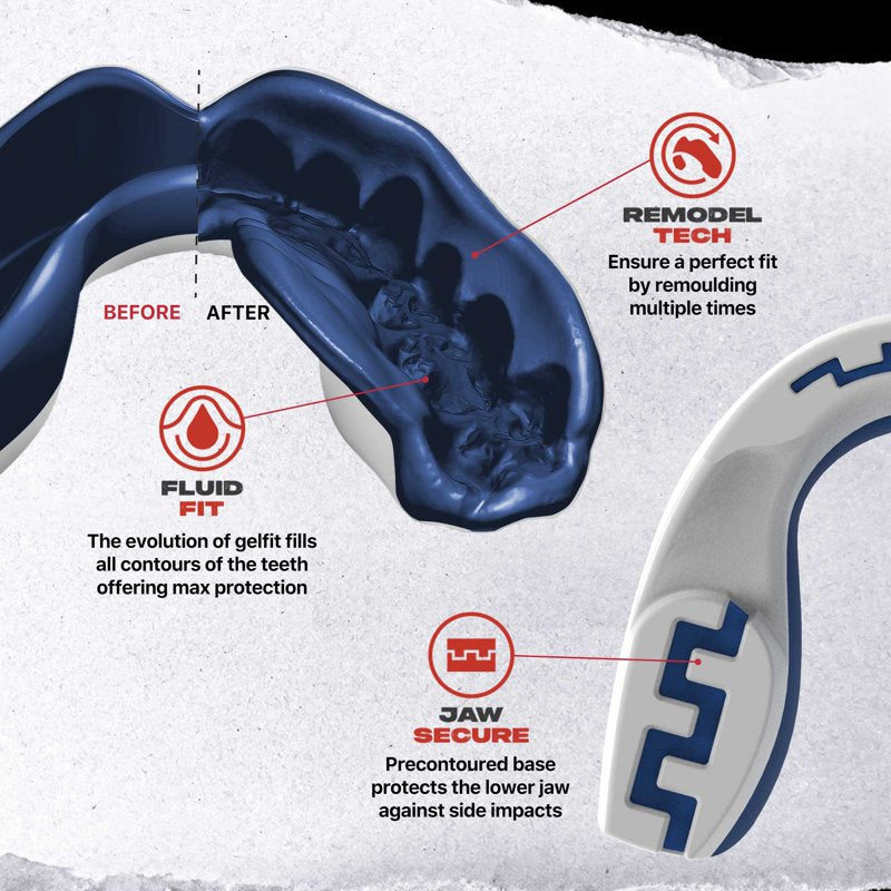 Sports Mouth Guard with Case - Dual Layer Impact Protection for Adults & Youth