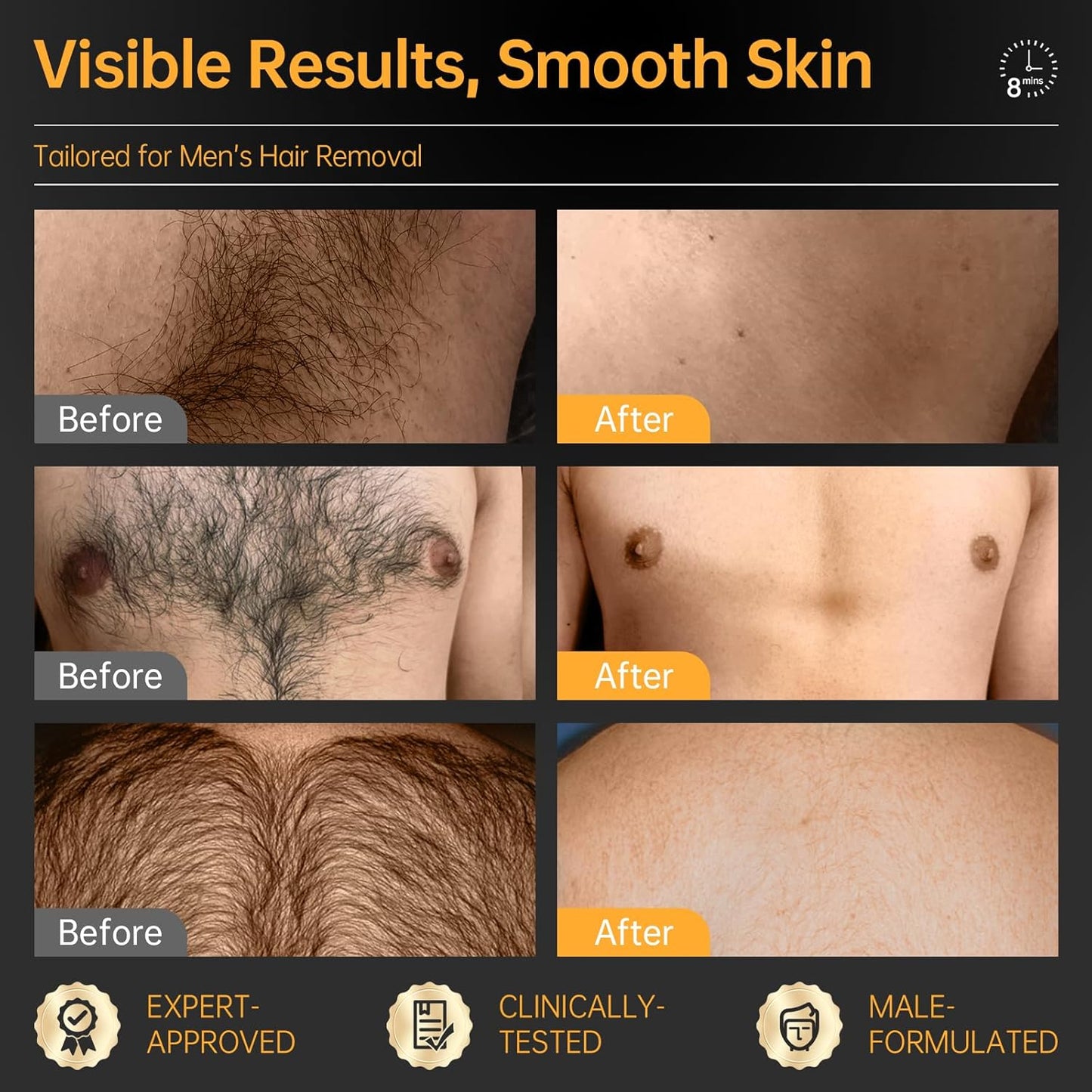 Men's Hair Removal Cream - Painless Depilatory Gel for All Skin Types, 3.38 FL OZ