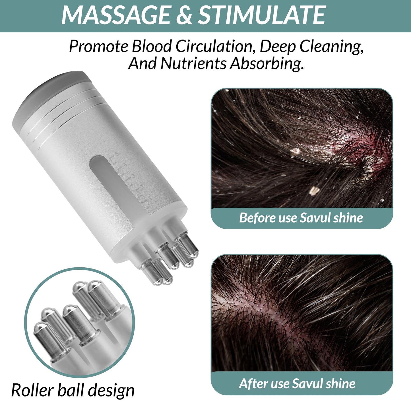 Savul Shine Scalp Oil Applicator, Essential Oil Applicator for Hair Root Growth, Hair Oil Applicator, Root Comb Applicator Bottle, Scalp Massager Hair Growth - Graduated 10ml Scale for Head Care