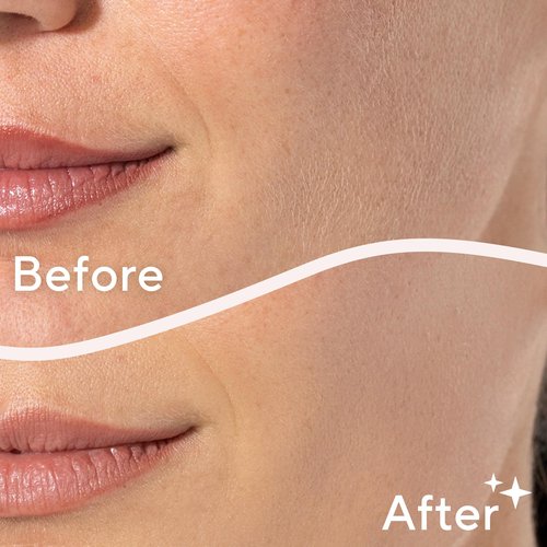 Finishing Touch Flawless Dermaplane Facial Exfoliator and Hair Remover, Facial Hair Removal for Women, 6 Count