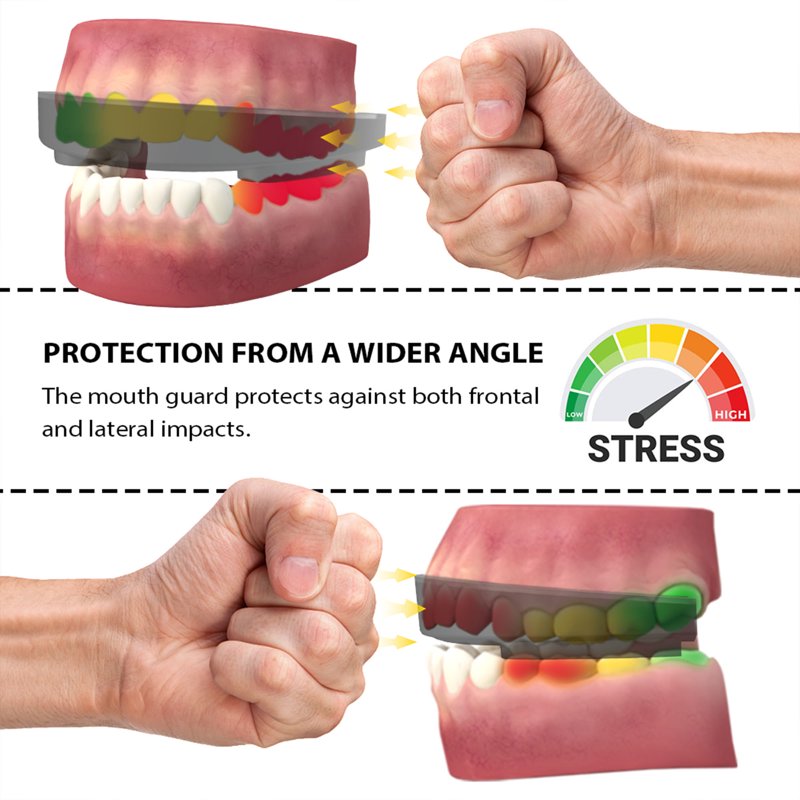 Sport Mouth Guard for Boxing, MMA, Basketball, Soccer & Contact Sports - Custom Fit, Impact Protection