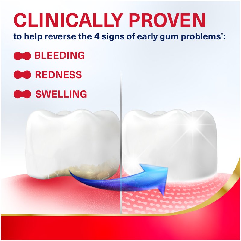 Whitening Toothpaste for Bleeding Gums - Parodontax Active Gum Repair Mint 3.4 oz