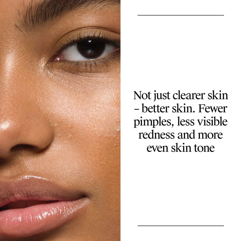 Oil-Free Acne Face Wash with Salicylic Acid & MicroClear Technology – 16 Fl Oz, 6 Fl Oz, 9.1 Fl Oz Variants
