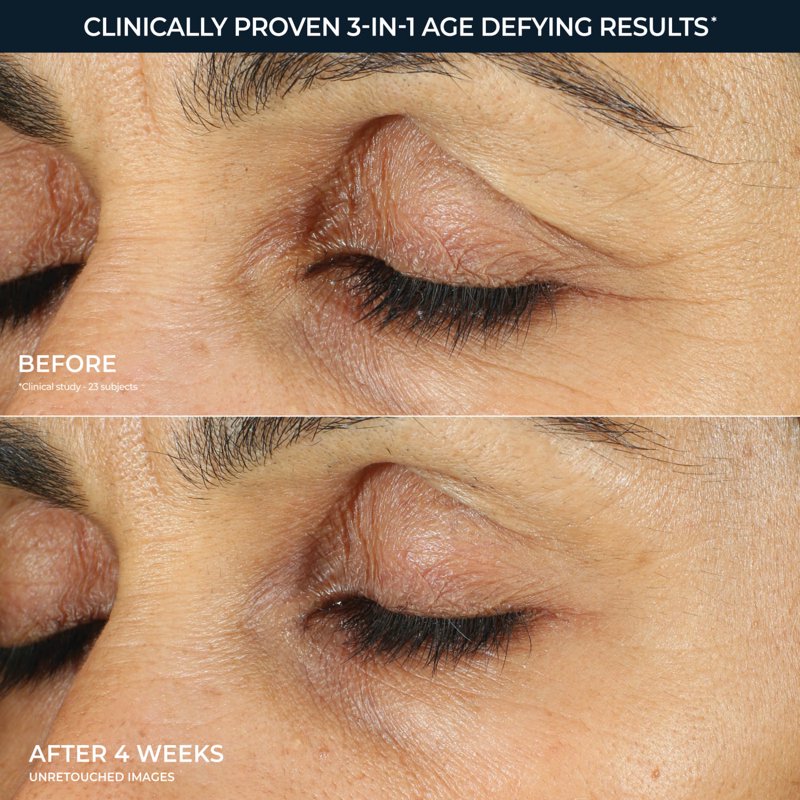 Retinol Eye Cream for Fine Lines Dark Circles Puffiness 0.5oz