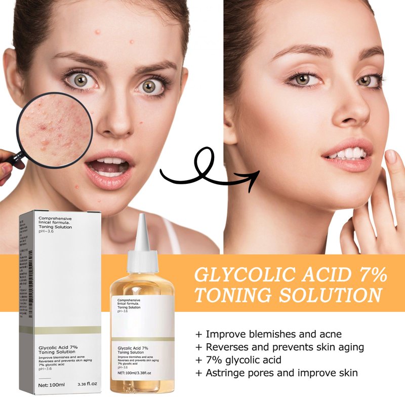 Glycolic Acid Face Toner - Hydrating Pore Refining Exfoliant, 3.38 fl oz