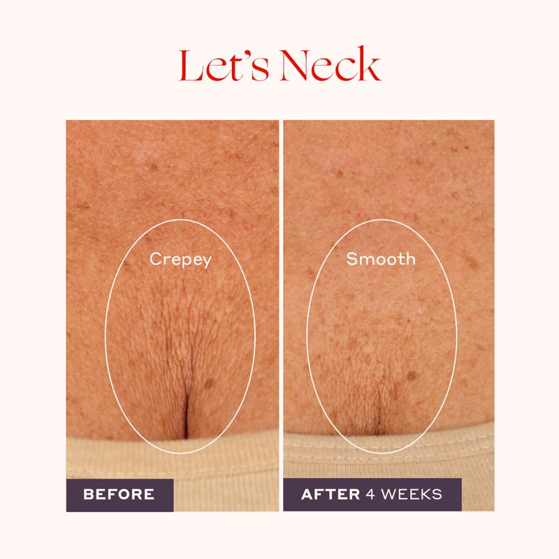 Neck Firming Serum with Cool Roll-On Applicator - Hydrate, Tighten & Smooth Crepey Skin - 1.7 Fl Oz