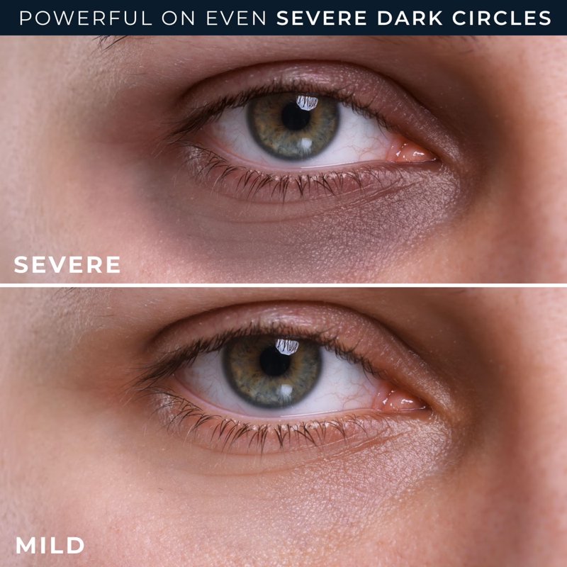 Dark Circle Eye Cream with Retinol & Niacinamide - Brightening Under Eye Treatment, 0.5 fl oz