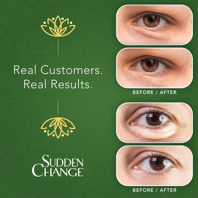 Under-Eye Firming Serum for Puffiness Lines & Wrinkles - 2 Pack