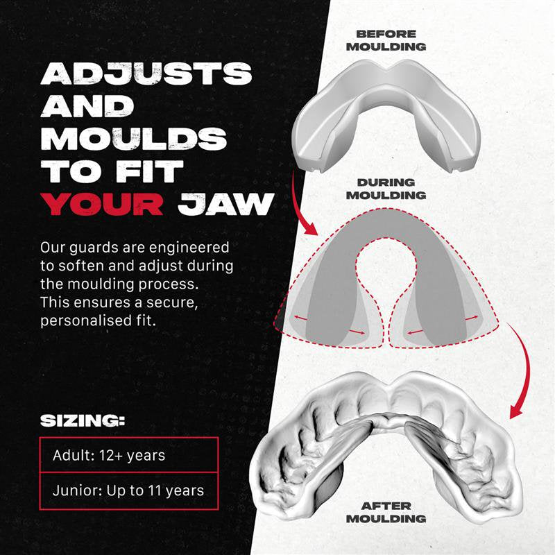 Re-Mouldable Sports Mouth Guard for Braces with Case - Full Impact Protection