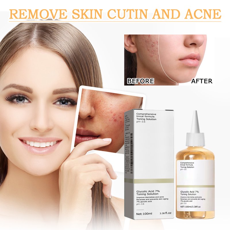 Glycolic Acid Face Toner - Hydrating Pore Refining Exfoliant, 3.38 fl oz