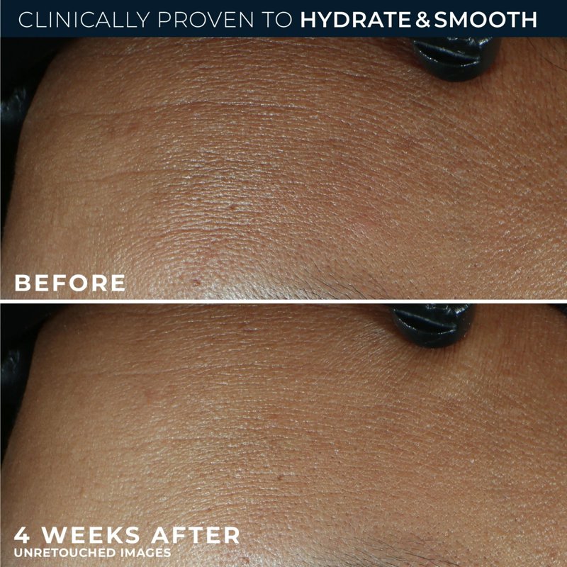Retinol and Hyaluronic Acid Face & Neck Moisturizer - 1.7 oz, Fragrance-Free, Hydrates 48H