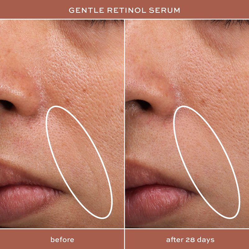 Hydrating Night Serum with Retinol for All Skin Types - 1 oz