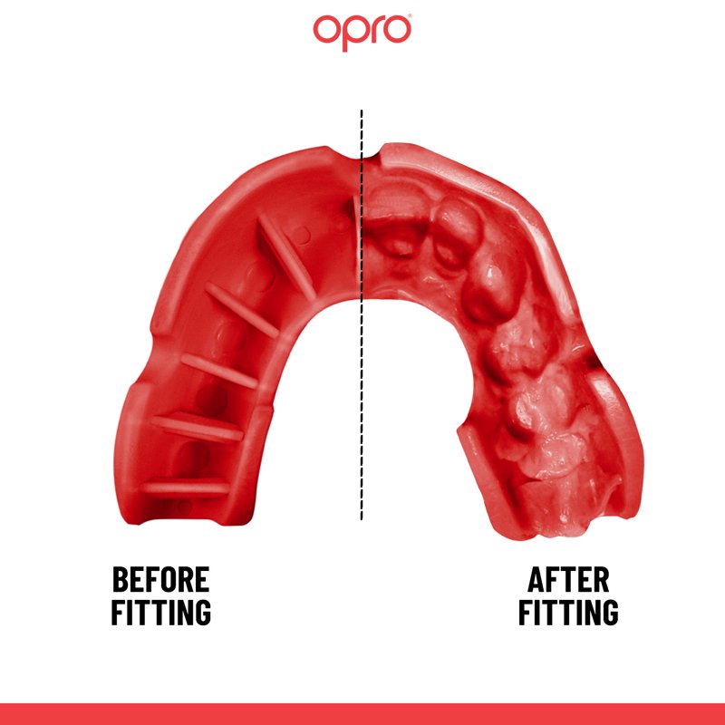 Self-Fit Boxing MMA Football Mouth Guard Level 3 Impact Protection