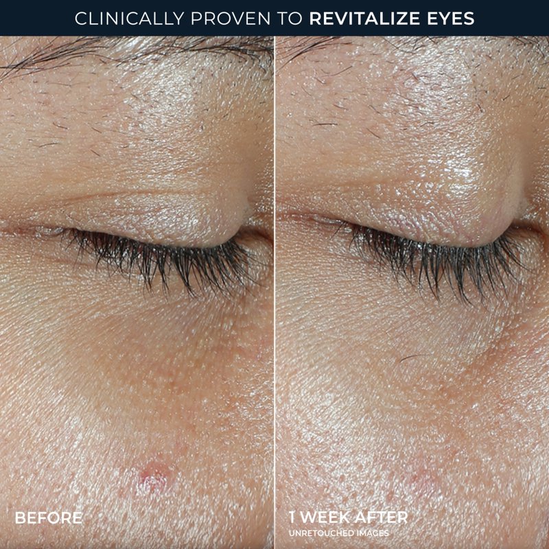 Revive + Glow Vitamin C Eye Balm Stick for Dark Circles & Puffiness