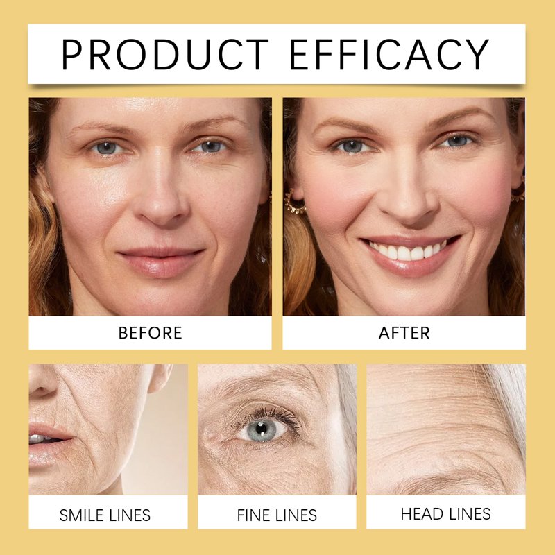 Retinol Collagen Face Moisturizer for Anti-Aging & Hydration - 1.7 fl oz